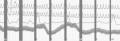 Polygraph Testing , Lie Detector Testing