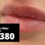 # 436