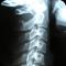 Our chiropractors are trained to alleviate the agony of neck pain.