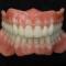 dentures