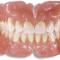 denture-repairs