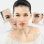 Acne and Acne Scar Treatments