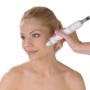 CACI Microdermabrasion