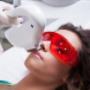 IPL Photorejuvenation