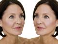 Before-and-After