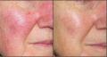 Before-and-After
