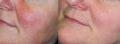 Before-and-After