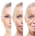 IPL-Photorejuvenation