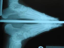 Dynamic Stride Podiatry Pty Ltd
