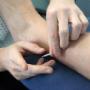 Dry Needling
