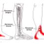 Trigger point therapy