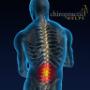 Back pain