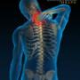 Neck pain