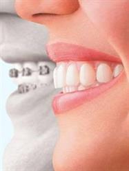 Caroline Springs Orthodontics