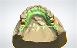 Dentacast Australia Pty Ltd