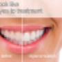 Preview results with Digital Smile Design.