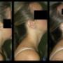 Uploaded by visitor on 22/2/2018 - Detailed assessment of neck movement and function
