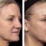 Cosmetic Clinic Brisbane
