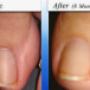 Laser Clinic Brisbane
