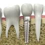 cosmetic dentist victoria point