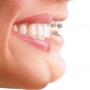 Wyndham Dental Care Orthodontic Braces