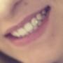 Tooth Jewellery