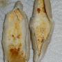 Results from an Ear Candling Treatment