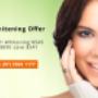 Teeth Whitening Offer