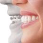 Invisalign invisible braces