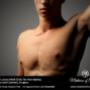 Uploaded by visitor on 24/8/2016 - Laser Hair Removal Adelaide - Medicine of Cosmetics