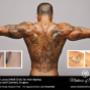 Uploaded by visitor on 24/8/2016 - Tattoo Removal Adelaide - Medicine of Cosmetics
