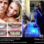 Uploaded by visitor on 24/8/2016 - Teeth Whitening Adelaide - Medicine of Cosmetics
