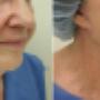 Norwood Day Surgery