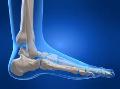 Foot Surgery