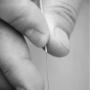 Acupuncture
