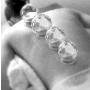 Cupping