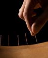 Acupuncture