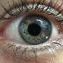 Iridology