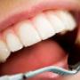 dentist teeth