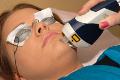 IPL Photorejuvenation