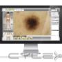 Uploaded by visitor on 1/12/2016 - Bondi Junction Skin Cancer Clinic treat all skin cancers