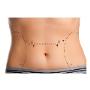 Dr Peter Randle Plastic Surgeon