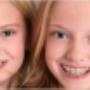 Braces