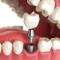 Dr-Paulo-Pinho-Oral-Surge
