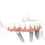 implants Perth