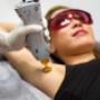 Laser Hair Removal