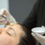Chemical Peels