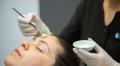 Chemical-Peels