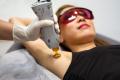 Laser Hair Removal