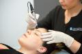 Microdermabrasion
